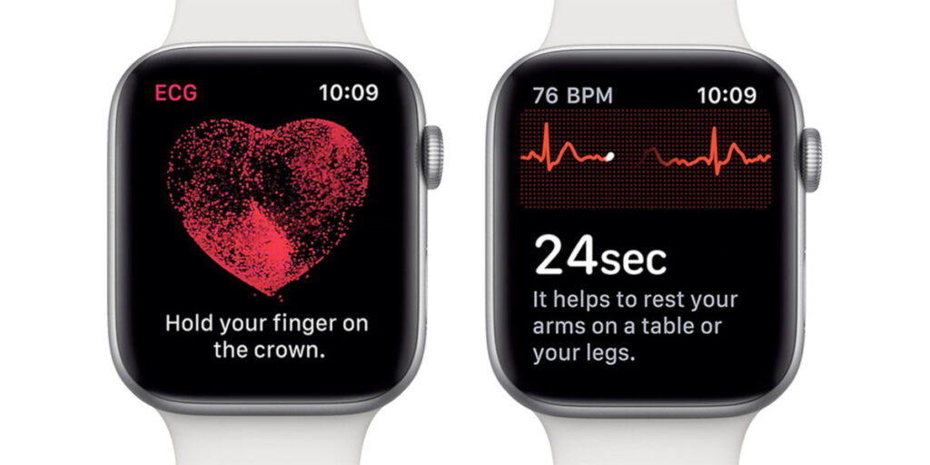 Казахстанец добился активации функции ЭКГ в Apple Watch через портал eotinish.kz